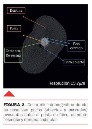 CEMENTO  ODONTOLOGíA BÁSICA.